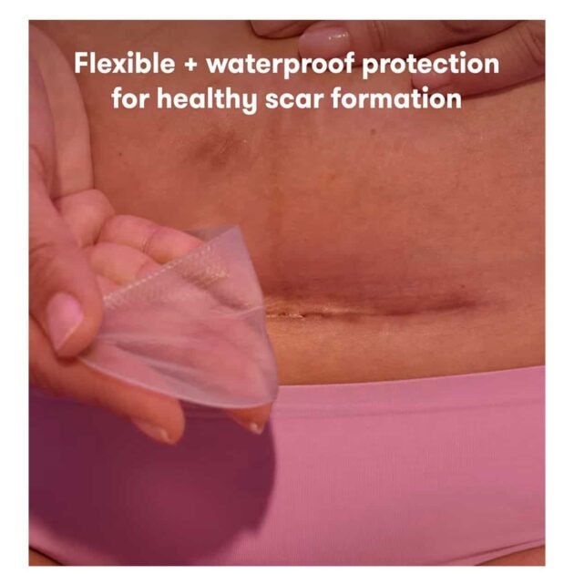 Frida Mom C-Section Silicone Scar Patches – view 3